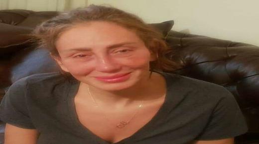 ريهام سعيد تعترف: تم إزالة أنفي بالكامل والدكتور بنى غيرها من أذني